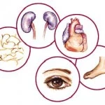 diabetes y complicaciones